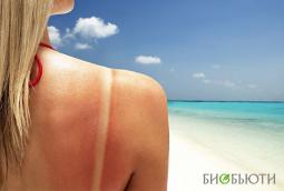 Как восстановить кожу после «солнечных ванн»?