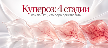 Четыре стадии купероза: как меняется кожа и почему важно не упустить момент