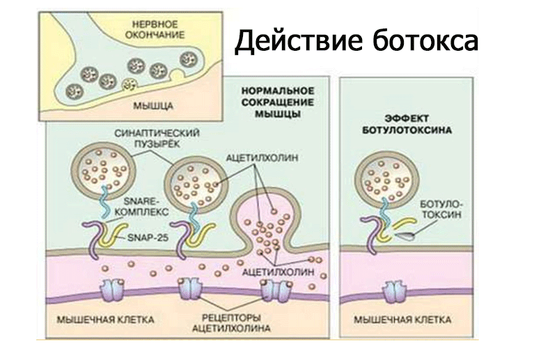 Фото Ботокса Глаз