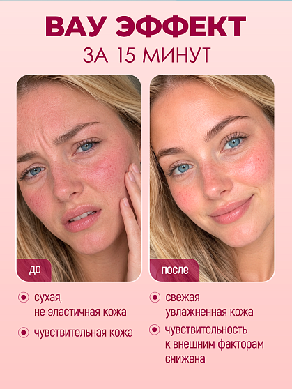 Маска гелевая «Антикупероз» MineraLife