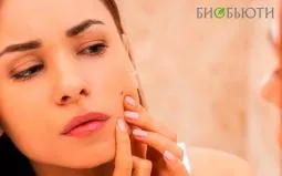 5 привычек, которые провоцируют появление акне